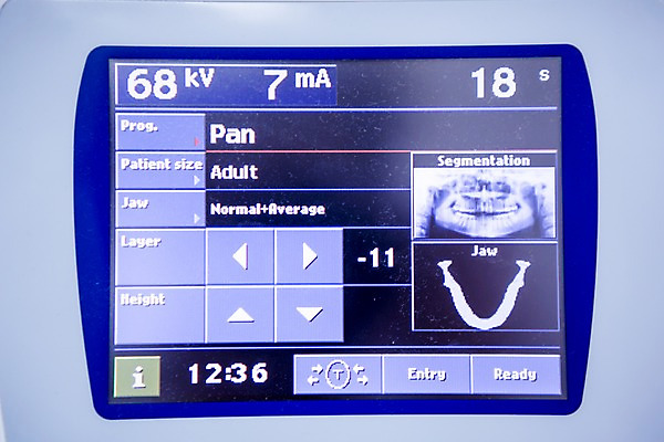 포토 JPG 의료기기 실내 치과 병원 사람없음 스크린 자료 기계 터치 치과용품 CT촬영 국내포토 의학 내부 의료용품 파일형식
