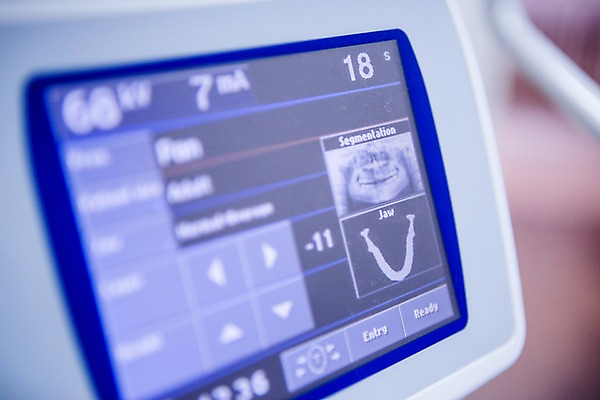 포토 JPG 의료기기 실내 치과 병원 사람없음 스크린 자료 기계 터치 치과용품 CT촬영 국내포토 의학 내부 의료용품 파일형식