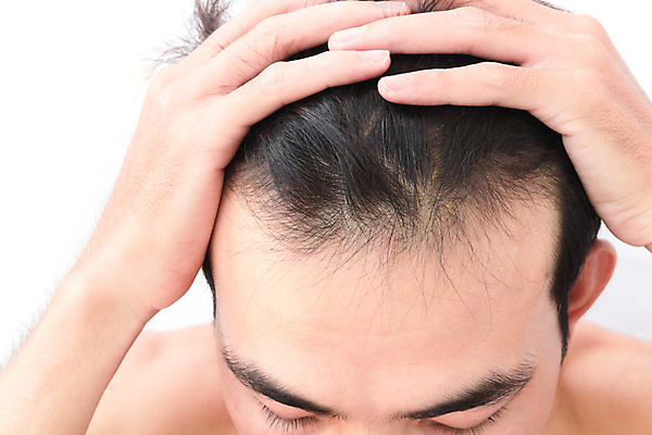 포토 JPG 해외이미지 손 남자 한명 성인 신체부위 뷰티 머리카락 머리 흰배경 헤어관리 감싸기 두피관리 두피케어 탈모 탈모클리닉 성인남자한명만 해외202004 탈모예방 해외포토 1 백그라운드 모션 사람 흰색 예방 클리닉 증상 남자한명만 성인남자만 파일형식 이미지허브