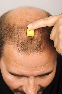 포토 JPG 해외이미지 손 남자 한명 들기 상반신 성인 신체부위 뷰티 머리카락 머리 키보드 누름 흰배경 대머리 두피케어 탈모 탈모클리닉 성인남자한명만 해외202004 탈모예방 해외포토 1 헤어스타일 백그라운드 모션 사람 흰색 예방 클리닉 헤어관리 증상 남자한명만 성인남자만 파일형식 이미지허브