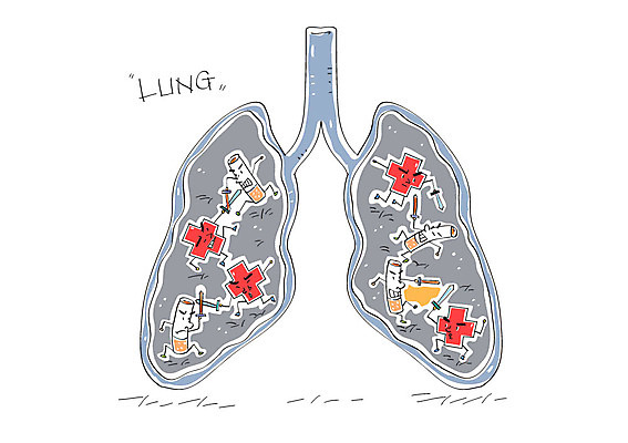일러스트 담배 사람없음 허파 칼 장기 칼싸움 국내일러스트 AI파일 신체 호흡기관 싸움 파일형식 벡터