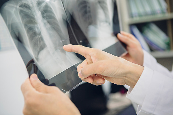 포토 JPG 손 남자 의학 엑스레이 실내 병원 들기 손짓 성인 두명 신체부위 진료 한국인 의사 가리킴 진료실 국내포토 모션 사람 동양인 내부 의료진 파일형식