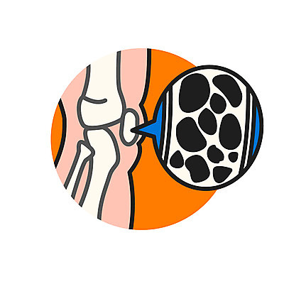 클립아트 아이콘 의학 뼈 신체부위 다리 골다공증 2D아이콘 AI파일 사람 질병 파일형식 벡터