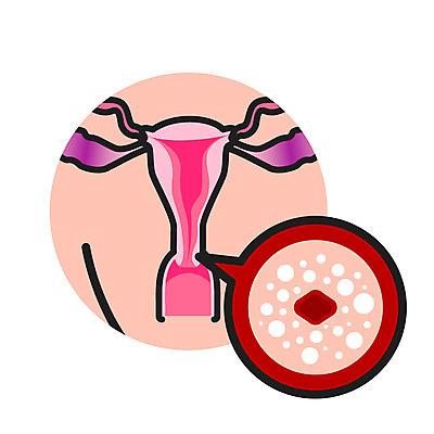 클립아트 아이콘 여자 의학 한명 성인 자궁 자궁경부암 2D아이콘 AI파일 1 사람 장기_의학 암 파일형식 벡터