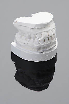 포토 JPG 의학 치과 그림자 사람없음 오브젝트 치아모형 석고 석고모형 국내포토 병원 모형 치아 파일형식