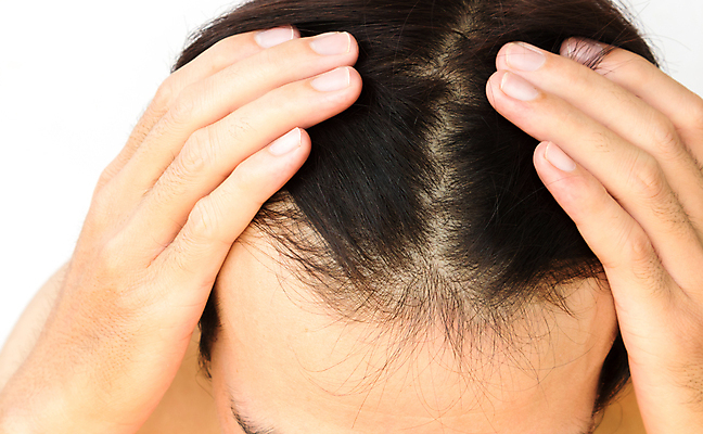 포토 JPG 해외이미지 손 남자 한명 상반신 성인 신체부위 뷰티 머리카락 머리 흰배경 헤어관리 감싸기 두피관리 두피케어 탈모 탈모클리닉 성인남자한명만 해외202004 탈모예방 해외포토 1 백그라운드 모션 사람 흰색 예방 클리닉 증상 남자한명만 성인남자만 파일형식 이미지허브