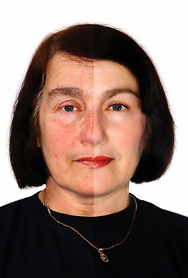 포토 JPG 해외이미지 백인 모델 편집 1 여자 얼굴 한명 사람 성인 뷰티 유행 화장품 활발 흰색 주름 매끈함 플라스틱 피부 피부관리 지우개 리프트 반대 외과 삭제 고립 돌봄 리프팅 전후 노화 해외202004 해외포토 서양인 컬러 컨셉 의학 모션 재질 학용품 병원 신체부위 감각 비교 파일형식 이미지허브