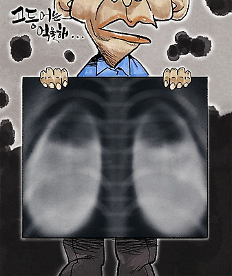 PSD 남자 일러스트 엑스레이 건강 한명 성인 환경오염 오염 허파 미세먼지 국내일러스트 1 컨셉 의학 사람 호흡기관 먼지 파일형식