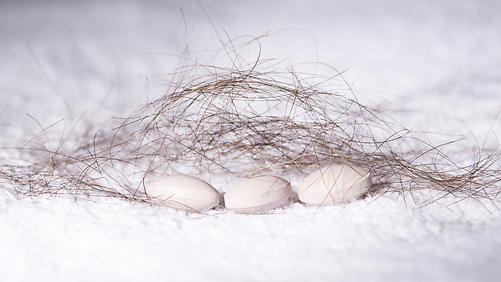 포토 JPG 해외이미지 근접촬영 사람없음 뷰티 알약 머리카락 흰배경 두피케어 치료제 탈모 탈모클리닉 해외202004 탈모예방 해외포토 뷰포인트 백그라운드 약 머리 흰색 예방 클리닉 헤어관리 증상 파일형식 이미지허브