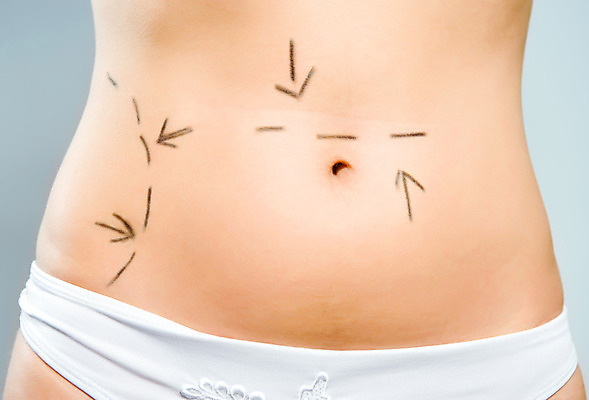 포토 JPG 해외이미지 백인 모델 여자 선 신체 화살 병원 성인 사람없음 뷰티 활발 환자 주름 수술 속옷 엉덩이 허리 사인 몸통 외과 복근 노화 셀룰라이트 해외202004 해외포토 서양인 옷 컨셉 의학 근육 사람 신체부위 치료 파일형식 이미지허브