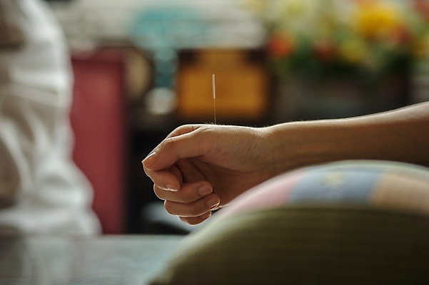 포토 JPG 손 여자 실내 성인 두명 신체부위 30대 진료 한의학 한국인 환자 한의원 한의사 침술 진료실 성인만 국내포토 의학 병원 사람 동양인 내부 장년 의사 파일형식