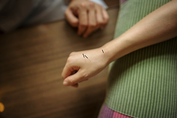 포토 JPG 손 여자 실내 성인 두명 신체부위 30대 진료 한의학 한국인 환자 한의원 한의사 침술 진료실 성인만 국내포토 의학 병원 사람 동양인 내부 장년 의사 파일형식