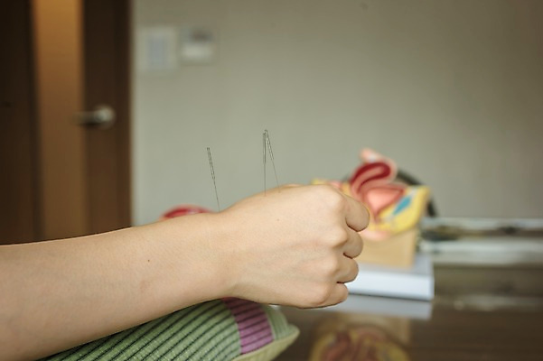 포토 JPG 손 여자 실내 한명 성인 신체부위 30대 진료 한의학 환자 한의원 침술 진료실 성인여자한명만 국내포토 1 의학 병원 사람 내부 장년 여자한명만 성인여자만 파일형식