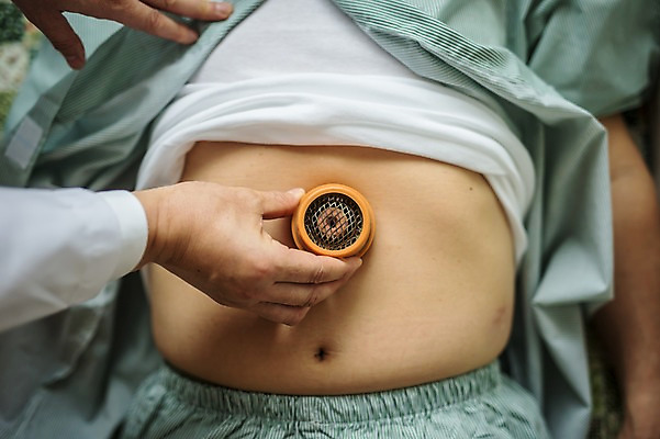 포토 JPG 손 노년 남자 실내 한명 앞모습 신체부위 치료 눕기 진료 한의학 한국인 환자 60대 한의원 뜸 진료실 복부 노인남자한명만 국내포토 1 뷰포인트 의학 모션 병원 사람 동양인 성인 내부 남자한명만 노인남자만 파일형식