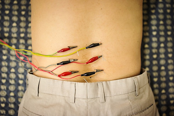 포토 JPG 노년 남자 엎드리기 한명 뒷모습 치료 진료 한의학 등 60대 연결 한의원 침술 국내포토 1 뷰포인트 의학 모션 병원 사람 성인 신체부위 파일형식