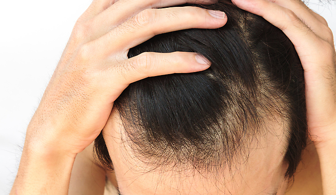 포토 JPG 해외이미지 남자 한명 근접촬영 성인 뷰티 머리카락 머리 흰배경 헤어관리 감싸기 두피관리 두피케어 탈모 탈모클리닉 성인남자한명만 해외202004 탈모예방 해외포토 1 뷰포인트 백그라운드 모션 사람 신체부위 흰색 예방 클리닉 증상 남자한명만 성인남자만 파일형식 이미지허브