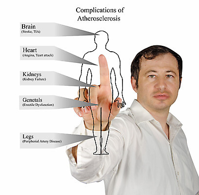 포토 JPG 해외이미지 남자 얼굴 컨셉 손가락 건강 한명 사람 치료 약 스크린 강사 의사 하트 가리킴 발표 질병 공격 강의 뇌 예방 동맥 돌봄 타격 가상 해외202004 해외포토 모양 직업 1 손 의학 모션 손짓 신체부위 의료진 혈관 파일형식 이미지허브