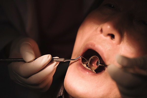 포토 JPG 여자 노년 남자 의학 조명 실내 치과 근접촬영 상반신 성인 두명 앞모습 치료 30대 눕기 어둠 한국인 치아 60대 치과의사 치과진료 성인만 국내포토 뷰포인트 모션 병원 사람 동양인 내부 장년 진료 의사 소화기관 파일형식