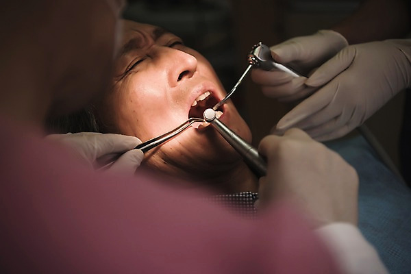 포토 JPG 여자 노년 남자 중년 50대 의학 실내 치과 앉기 상반신 성인 신체부위 세명 30대 눕기 고통 한국인 찡그림 60대 치과의사 치과용품 치과진료 진료실 국내포토 감정 모션 표정 병원 사람 동양인 내부 장년 진료 의사 의료용품 파일형식