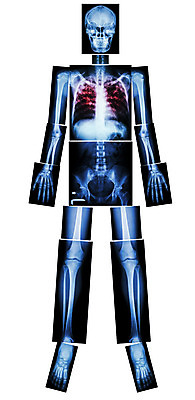 포토 JPG 해외이미지 백그라운드 신체 해부 골격 엑스레이 건강 병원 서기 사람 사람없음 약 고통 환자 의사 광선 호흡기관 질병 X 감염 전염 외과 박테리아 고립 돌봄 방사선 염증 전염병 해외202004 해외포토 알파벳 감정 의학 모션 의료진 장기_의학 파일형식 이미지허브