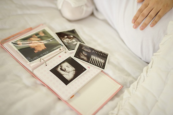 포토 JPG 여자 실내 한명 상반신 성인 옆모습 신체부위 30대 눕기 임산부 임신 한국인 침대 앨범 태교 초음파사진 성인여자한명만 쓰다듬기 국내포토 1 뷰포인트 가구 모션 사람 동양인 내부 장년 여자한명만 성인여자만 파일형식