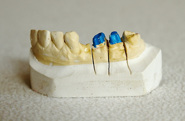 포토 JPG 해외이미지 모델 왕관 건강 치과 사람없음 금속 장비 과학기술 도자기 입 기술자 실험실 치아 치과의사 틀니 돌봄 백자 보철 해외202004 해외포토 직업 모션 재질 기술 병원 실험 신체부위 의사 소화기관 파일형식 이미지허브