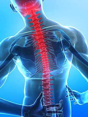 포토 JPG 해외이미지 신체 일러스트 해부 뼈 골격 엑스레이 건강 사람 사람없음 그래픽 3D 광선 X 엉덩이 척추 관절염 생물학 골다공증 몸통 궤 요통 해골모형 해외202004 해외포토 알파벳 교육 의학 신체부위 모형 질병 디지털합성 허리통증 파일형식 이미지허브