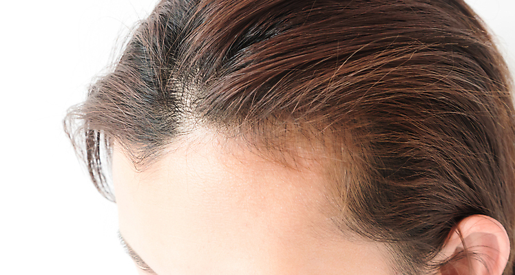 포토 JPG 해외이미지 여자 한명 근접촬영 성인 뷰티 머리카락 머리 흰배경 헤어관리 두피 두피관리 두피케어 탈모 탈모클리닉 성인여자한명만 해외202004 탈모예방 해외포토 1 뷰포인트 백그라운드 사람 신체부위 흰색 예방 클리닉 증상 여자한명만 성인여자만 파일형식 이미지허브