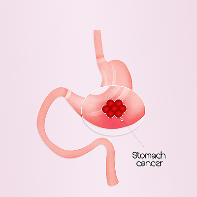 포토 JPG 해외이미지 일러스트 건강 사람없음 약 시험 오르간 계획 암 평가 외과 돌봄 방사선 해외202004 해외포토 교육 컨셉 의학 모션 병원 건반악기 질병 파일형식 이미지허브